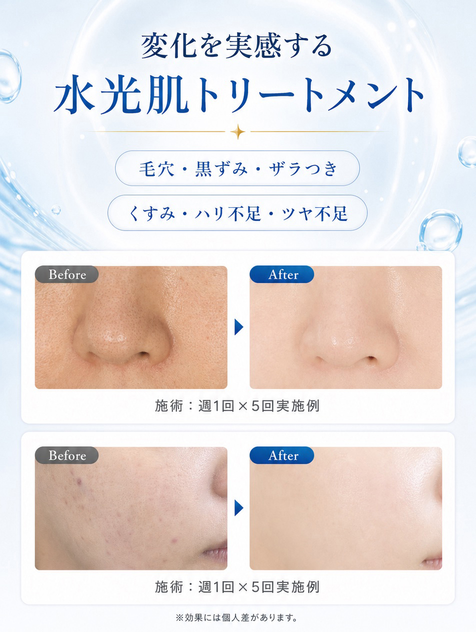 変化を実感する水光肌トリートメント 毛穴 黒ずみ ザラつき くすみ ハリ不足 ツヤ不足